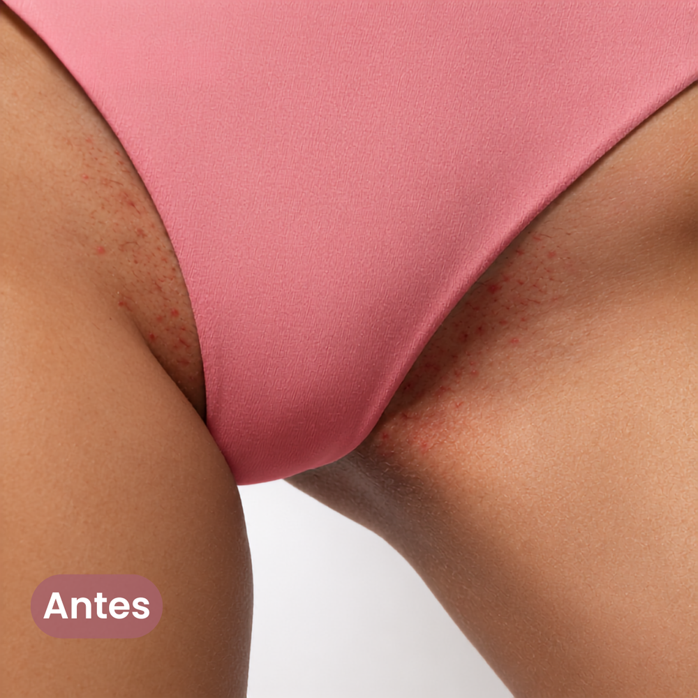 Antes